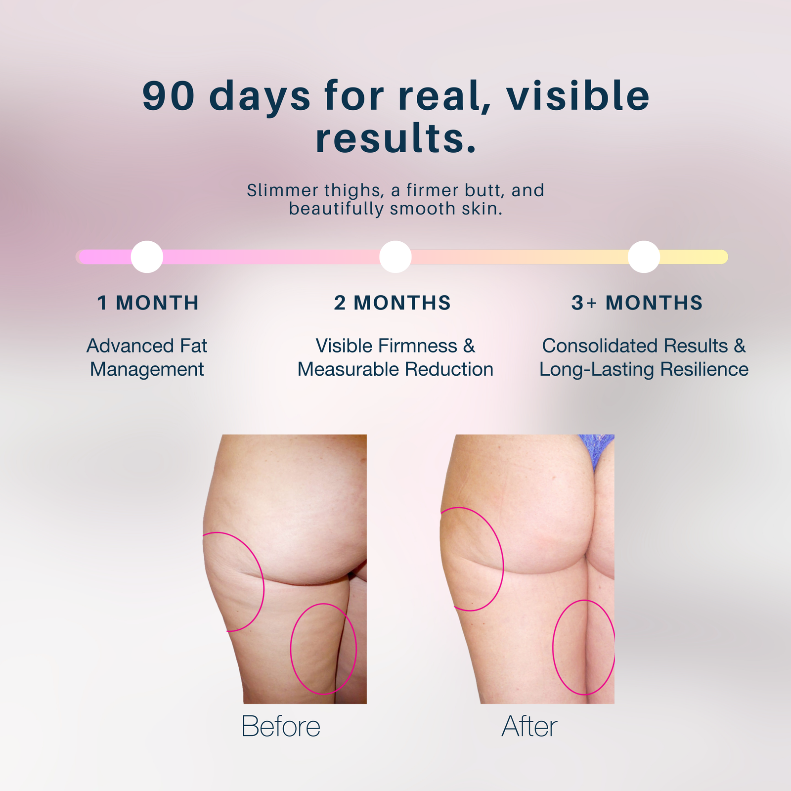 MyBodyContour