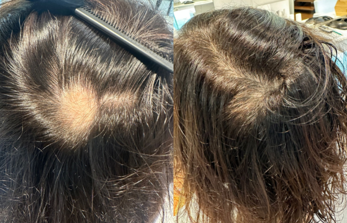 Thinning area & targeted care - Before